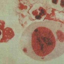 ��������Щ����֢״