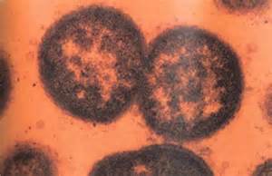 �������ǻḴ����ԭ������Щ