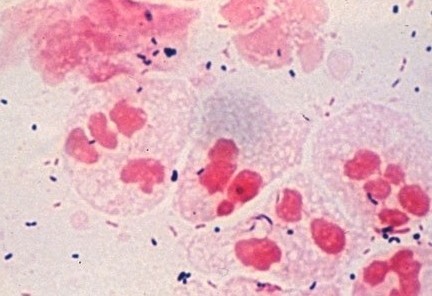 ��֦�����Ʒ��ܾ�������׺�